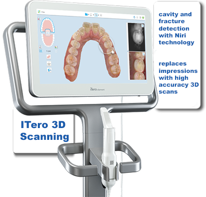 iTero Intraoral Camera