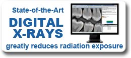 Digital X-Rays